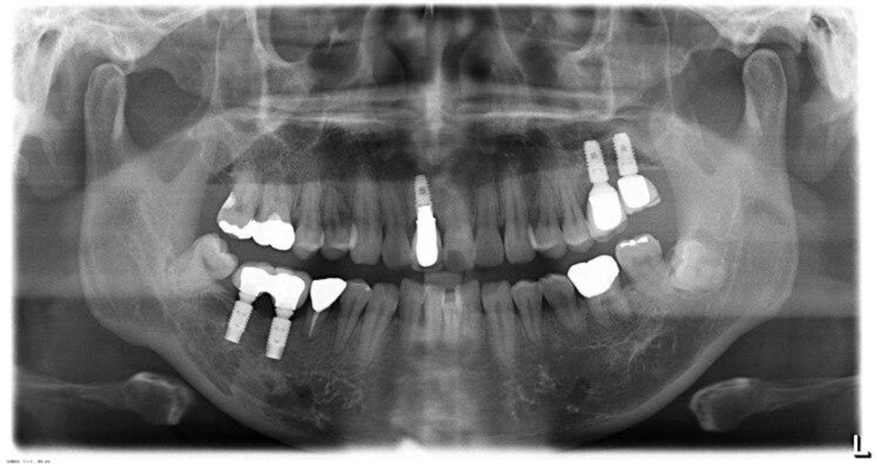 sirona-sirona-xg-3d-ready-panorex__18829