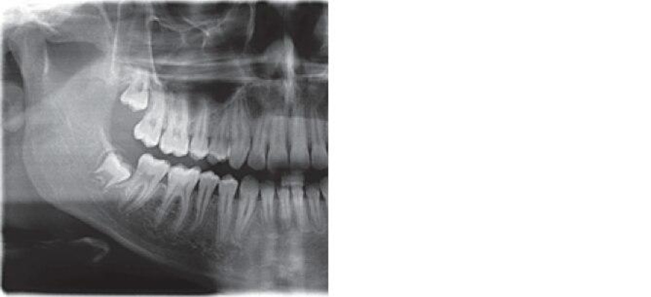 sirona-sirona-xg-3d-ready-panorex__33565