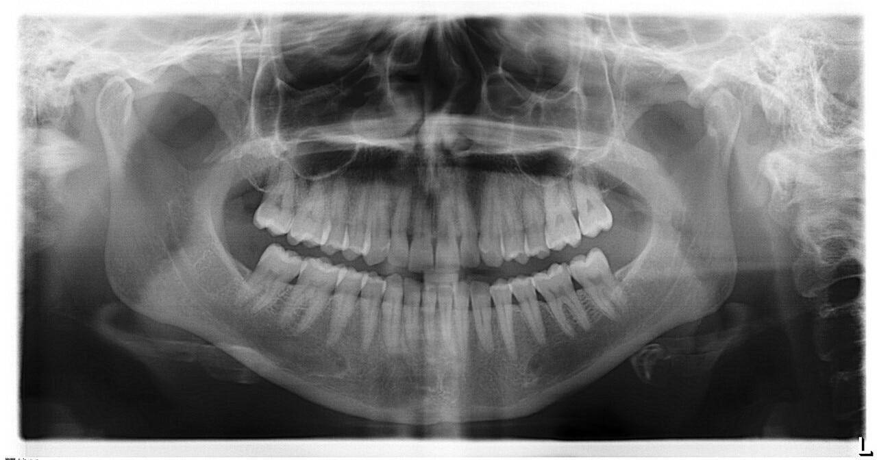 sirona-sirona-xg-3d-ready-panorex__42978