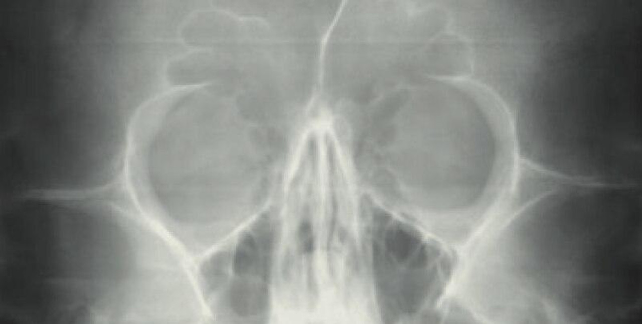 sirona-sirona-xg-3d-ready-panorex__47947